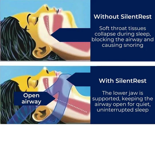 Full Head Chin Strap for Snoring Relief | Sleep Apnea Support - Comfortable - Night Use